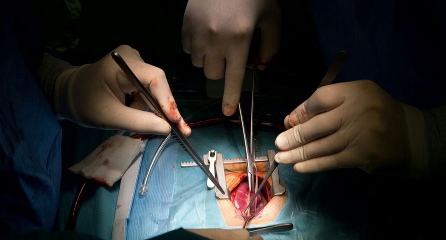 Zamiast CV przesłał "swoje wnętrzności". Czy nietypowa rekrutacja przeszłaby w Polsce?