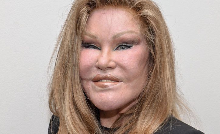 Jocelyn Wildenstein: From high society to plastic surgery icon