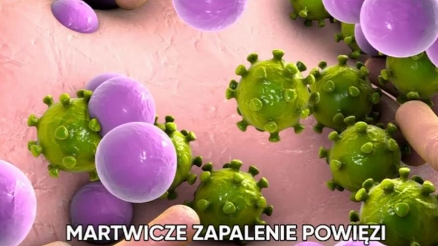 Choroby, które mogą zabić w ciągu doby