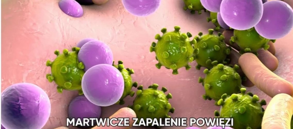 Choroby, które mogą doprowadzić do zgonu w ciągu doby (WIDEO)