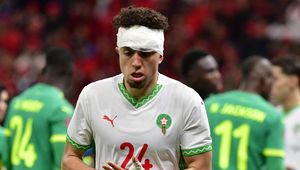 Szokujące sceny w finale Pucharu Narodów Afryki. Cyrk na boisku