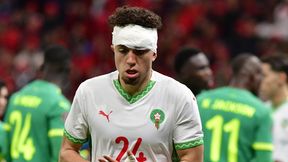 Szokujące sceny w finale Pucharu Narodów Afryki. Cyrk na boisku