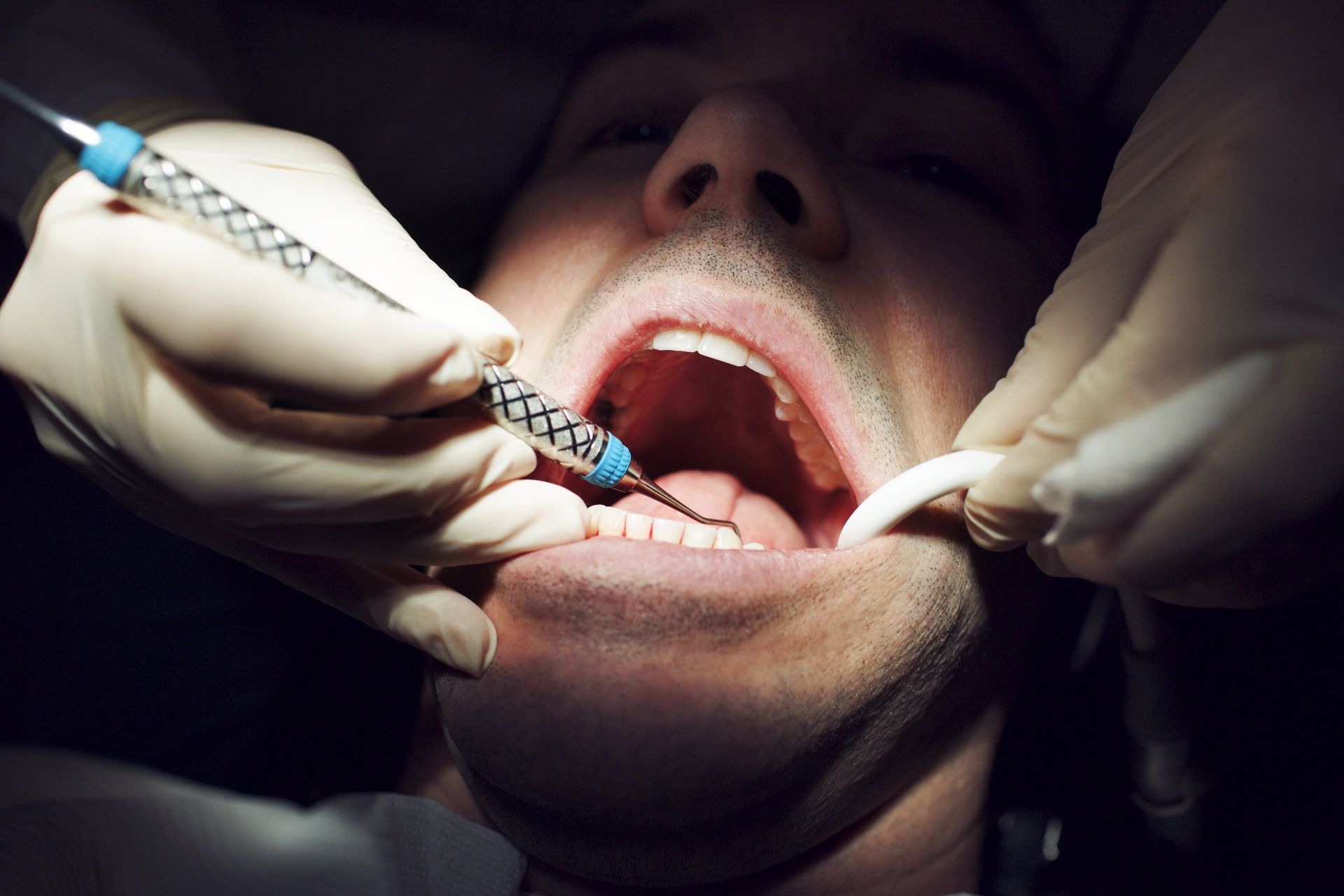 Turystyka dentystyczna Polaków. Tu jeżdżą po plomby za 50 zł