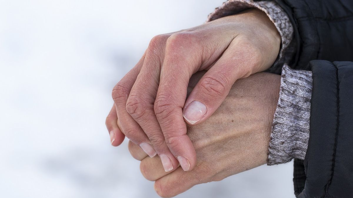 Zimą dłonie szybko stają się suche i popękane.