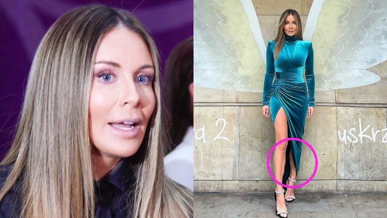 Fani wytykają retusz Małgorzacie Rozenek