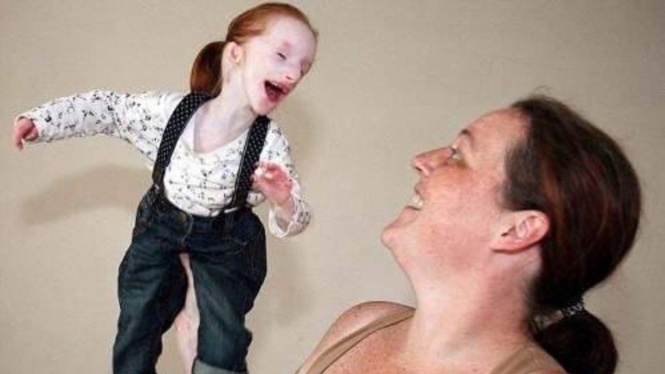 Lekarze nie dawali jej szans. "Najmniejsza dziewczynka na świecie"