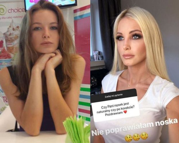 Roxi Gąska PRZYZNAŁA SIĘ DO OPERACJI! "Piersi nie są naturalne. Usta też powiększyłam"