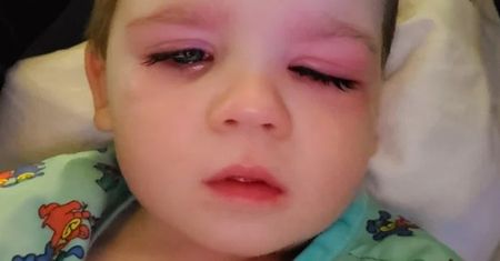Dziecko omal nie straciło oka. Mama przestrzega innych
