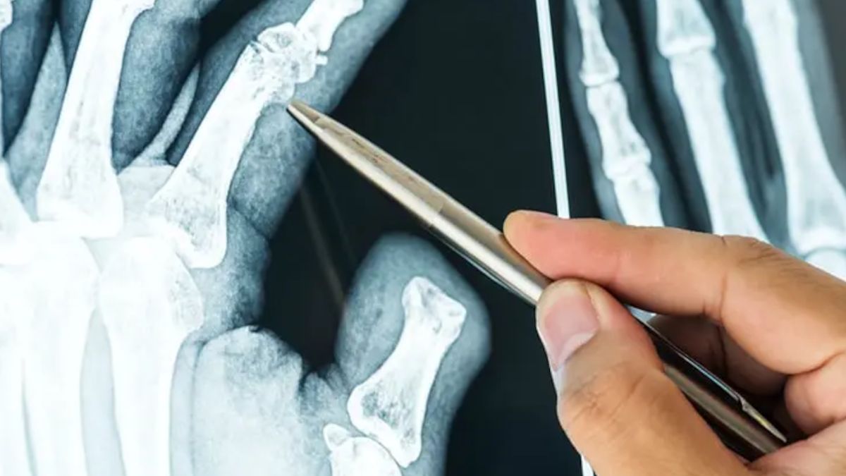 Sztuczna inteligencja w służbie zdrowia.