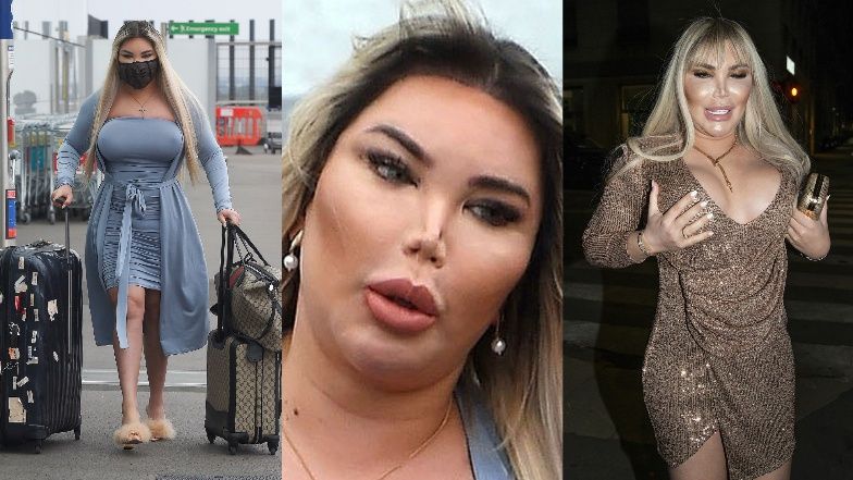 Rodrigo "Roddy" Alves powiększyła biust jeszcze bardziej?