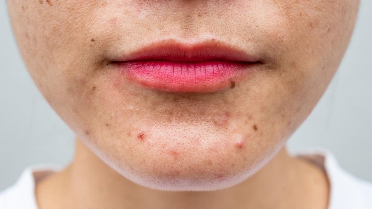 Zaburzenia widzenia są charakterystyczne przy niedoborze witaminy A