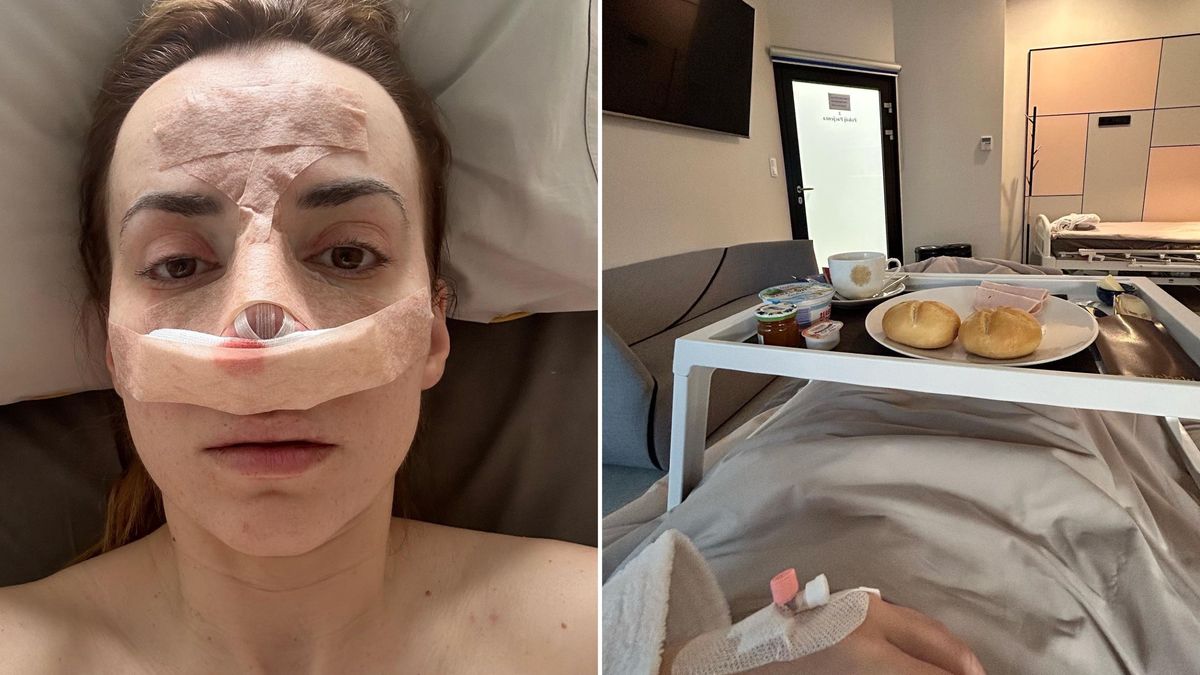 Marianna Schreiber przeszła zabieg