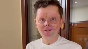 Maciej Krzysik nagrał film ze szpitala. "Chcę was uspokoić"