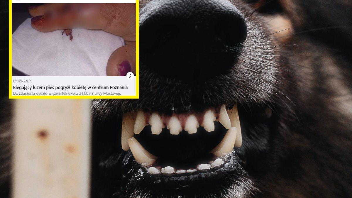 Pies pogryzł kobietę