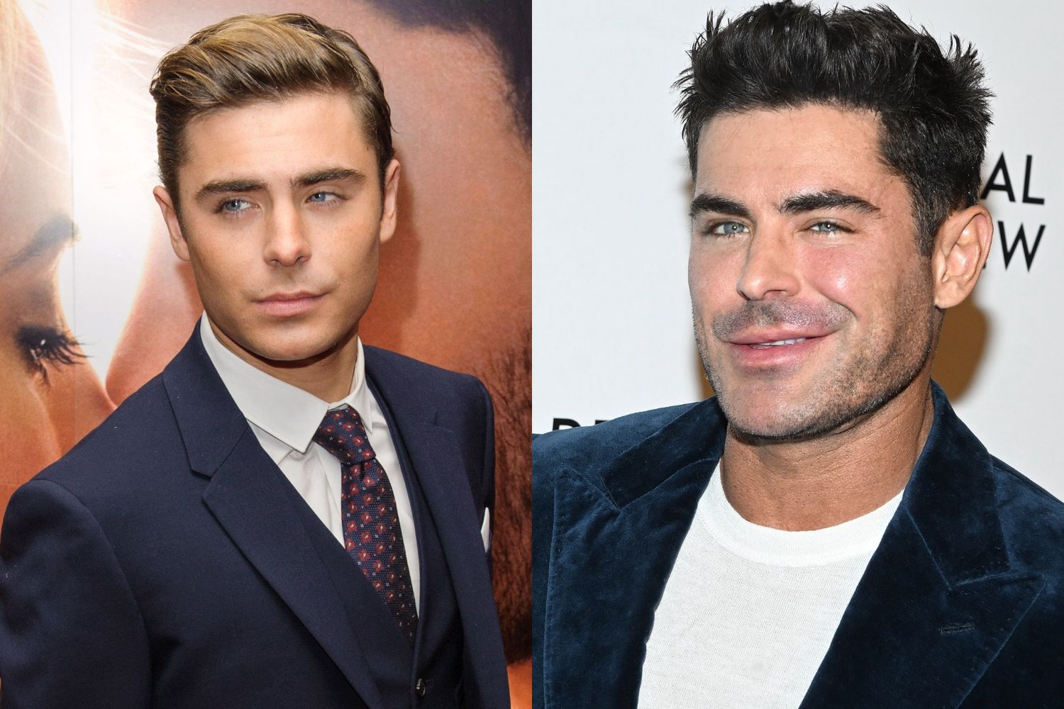 Zac Efron i operacje plastyczne
