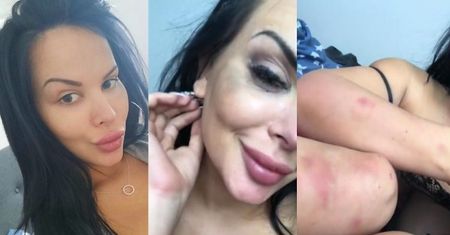 Pobita (?) Esmeralda Godlewska atakuje siostrę: "Wszyscy wiedzą, za co otworzyłaś klinikę!"