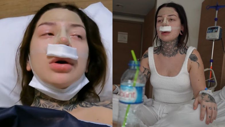 Marcysia Ryskala zrobiła operację nosa