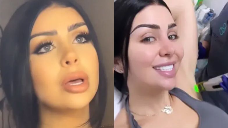 Dramat influencerki z zębami z Turcji