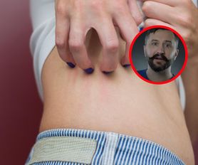 Takie objawy daje rak trzustki. "Okrada chorego z substancji odżywczych"