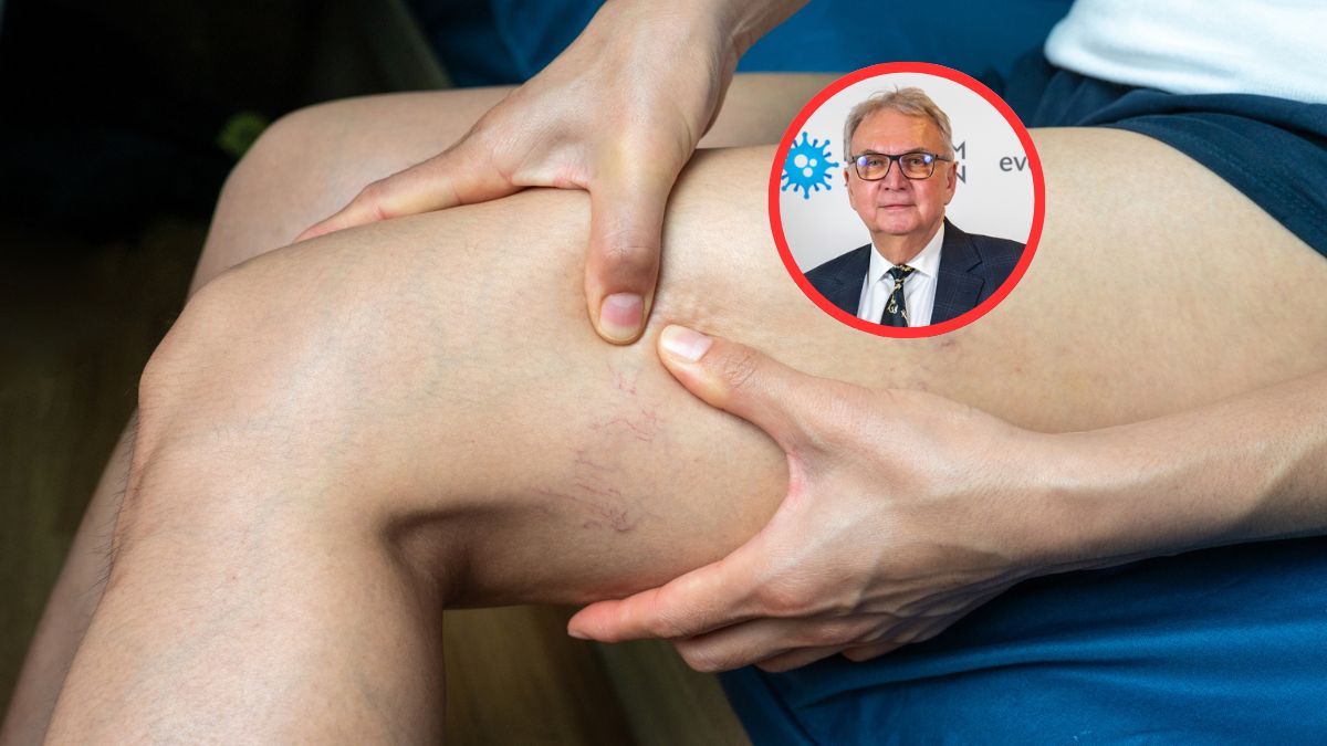 Objawy nie zawsze są oczywiste