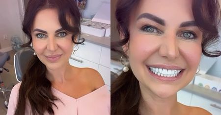 Maja Rutkowski przykleiła sobie na zęby diament w kształcie MOTYLA. Internauci krótko: "Ale KICZ!" (WIDEO)