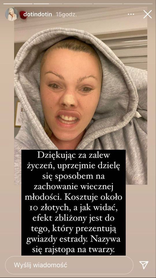 Dorota Szelągowska wyśmiewa operacje plastyczne