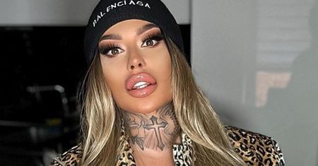 Laluna Unique WYRETUSZOWAŁA swoje zdjęcie ze stołu operacyjnego?! "Uwielbiam PLASTIK, uwielbiam filtry i ch*j komu do tego" (FOTO)
