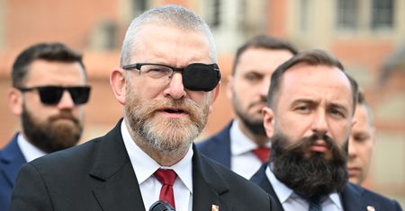 Grzegorz Braun z opaską na oku. Zdradził powód