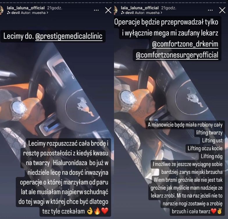 Laluna Unique zapowiada kolejną operację