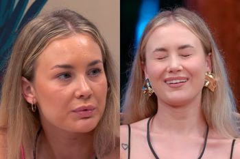 Miała korektę nosa. Natalia z "Hotelu Paradise" pokazała stare zdjęcie