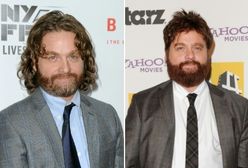 ''Kac Vegas'': Zach Galifianakis schudł i wyprzystojniał