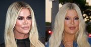 Tori Spelling komentuje porównania swojej nowej twarzy do Khloe Kardashian. "Jestem zaszczycona"