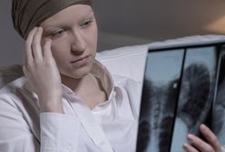 Polisy nowotworowe coraz bardziej popularne w Polsce. Szerszy zakres ubezpieczenia niż NFZ