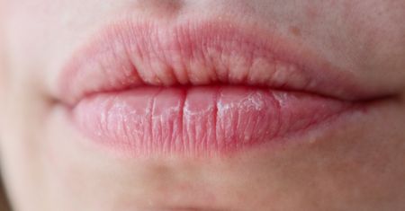 Maść z apteki za kilka złotych. Nawilża lepiej niż balsam