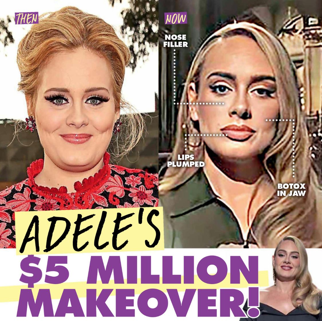 Adele miała operacje plastyczne?