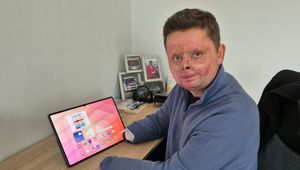 "Wywinąłem się spod łopaty". Maciej Krzysik o tragicznym wypadku