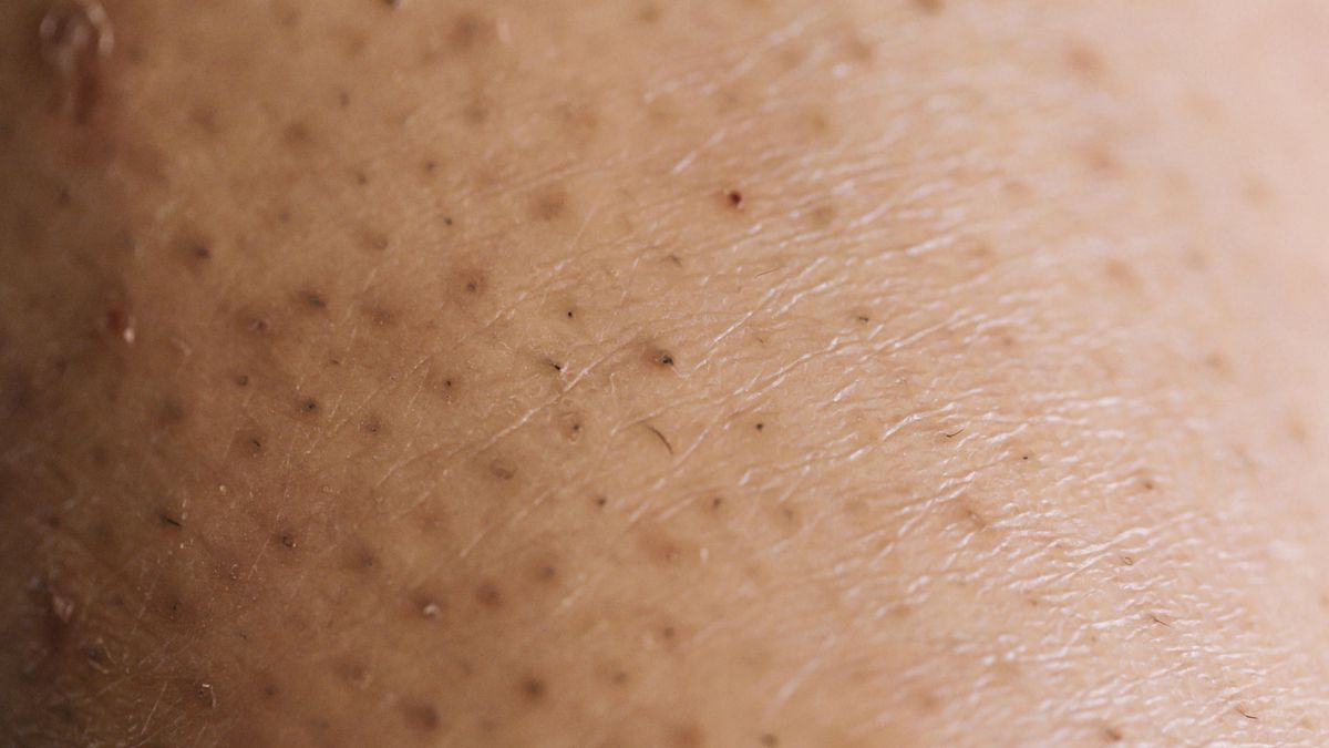 Jak sprawić, by włoski nie wrastały