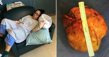 Mąż myślał, że jest opętana. Miała zapalenie mózgu