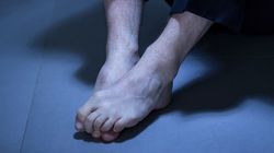 Ten objaw pojawia się na stopach. To znak, że wątroba jest na wykończeniu