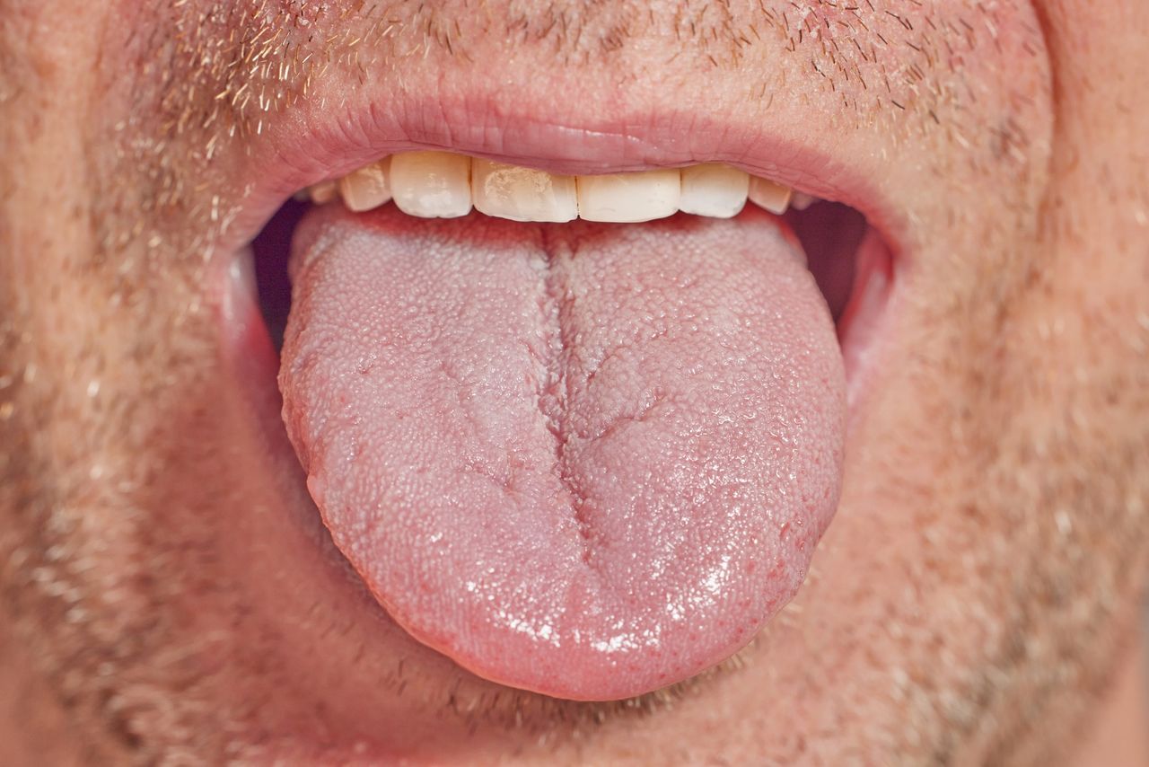 Pay attention to the appearance of the tongue. This could be a sign of illness.