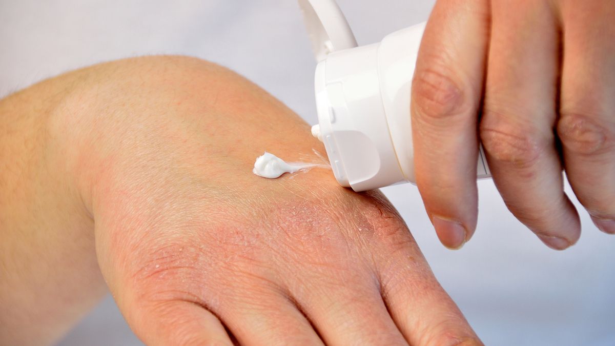 Kremy dla alergików