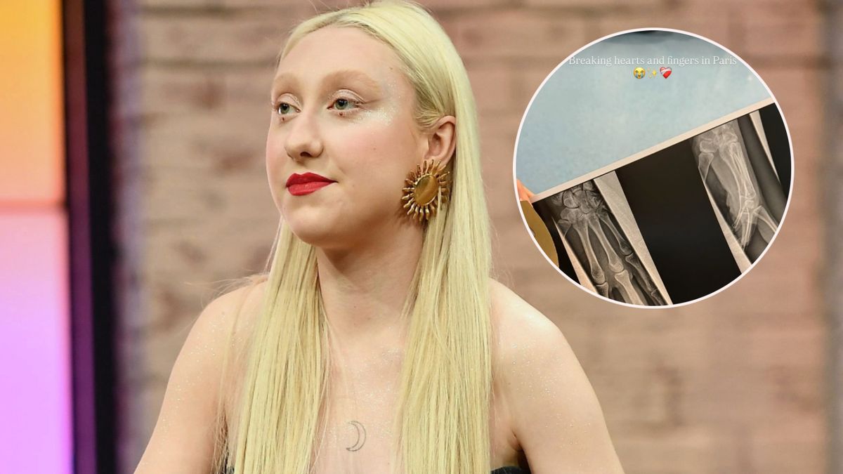 Luna narzeka na francuską służbę zdrowia