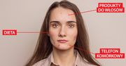 Czy telefon komórkowy powoduje trądzik? Ekspert wyjaśnia (WIDEO)