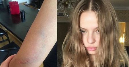 Magdalena Frąckowiak ZOSTAŁA ZAATAKOWANA u jubilera! "Mam cały łokieć obolały w siniakach"