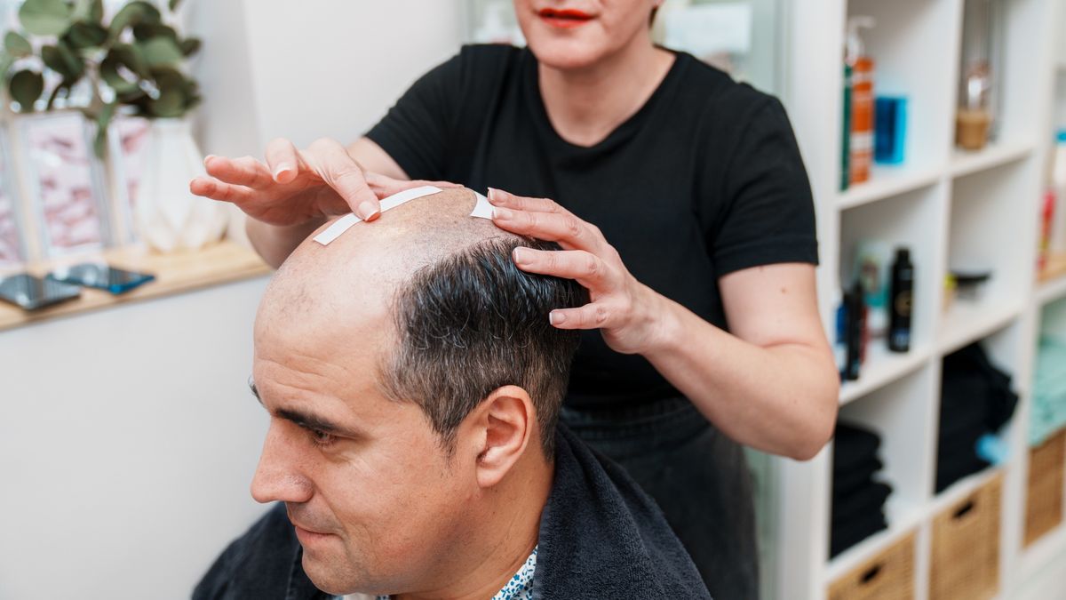 Hairdresser Transforming Bald Man's Look: Sticker Fun in Hair Clinic Before Wig Application
A hairdresser in a hair clinic playfully applies stickers on a bald man's head before fitting him with a wig, creating a remarkable transformation
KoldoyChris