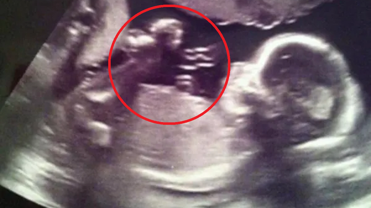 Szczegół na zdjęciu USG zwrócił jej uwagę. Ten widok chwyta za serce