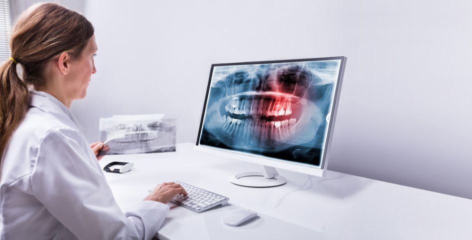RTG zęba jest badaniem radiologicznym, które polega na wykonaniu prześwietlenia zębów.