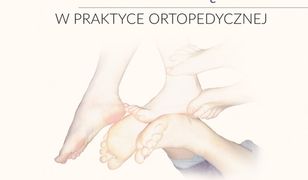 Stopa dziecięca w praktyce ortopedycznej