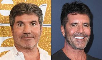 Simon Cowell USUNĄŁ z twarzy wypełniacze, bo... syn zaczął się go BAĆ: "WPADŁ W HISTERIĘ"