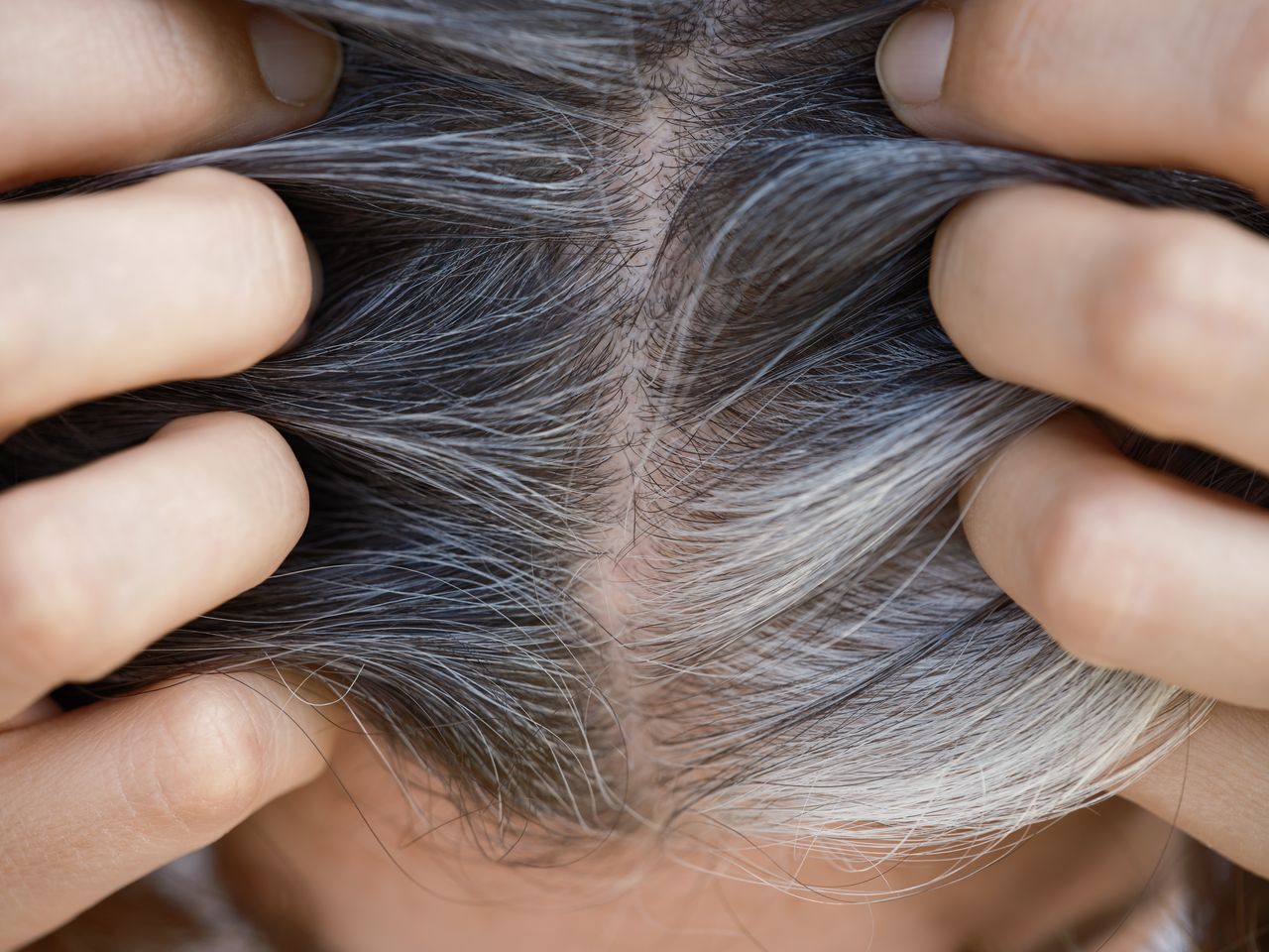 Home remedies for gray hair